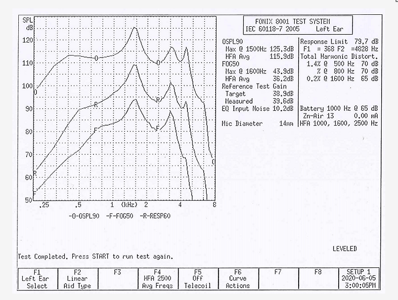 hearing aids testing report|ennohearingaid